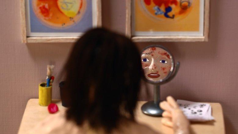 Blackheads image